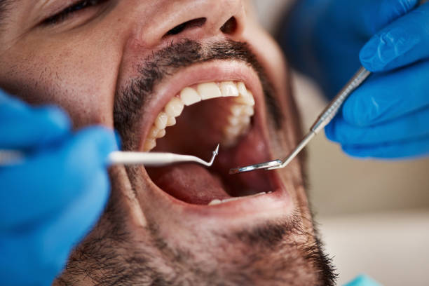 Best Emergency Dental Services for Seniors in Murphy, TX